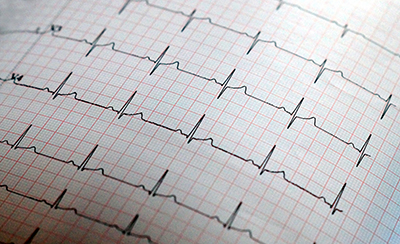 EKG Kurve auf einem Blatt Papier